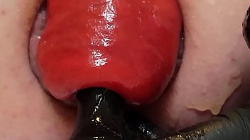Contender For Biggest Prolapse (Male Warning!) free video